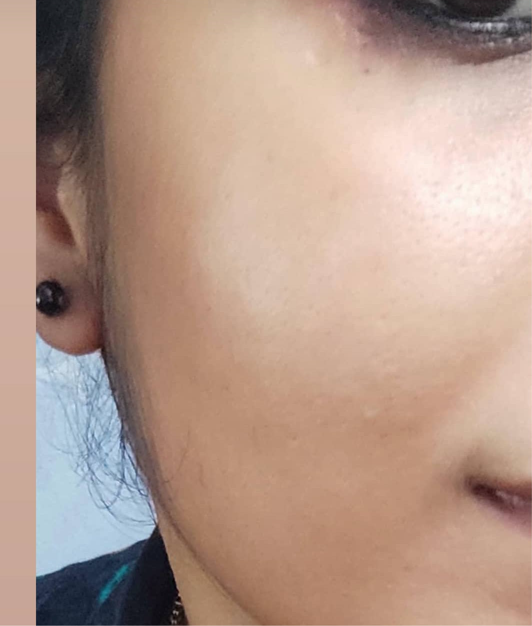 Clear skin combo